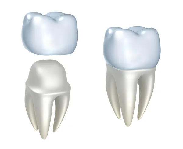 Zubní korunky a zub, izolované na bílém — Stock fotografie