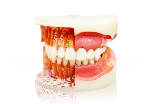 白で隔離される総義歯 — ストック写真