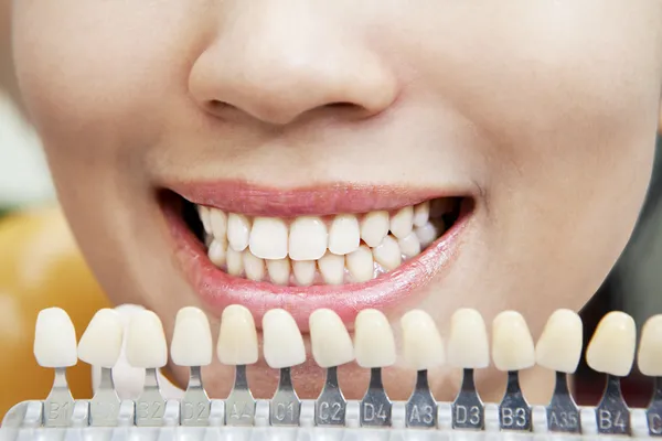 Examinar os dentes 1 — Fotografia de Stock