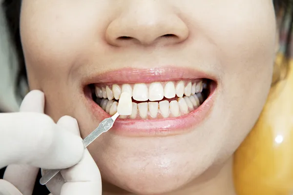 Prověřování zuby — Stock fotografie