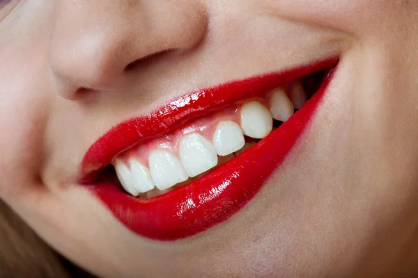 Perfect smile healthy — Stock Photo, Image
