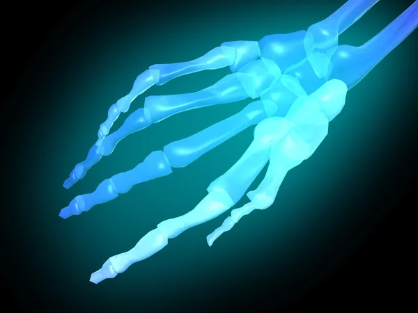 Palma do esqueleto raios-X — Fotografia de Stock