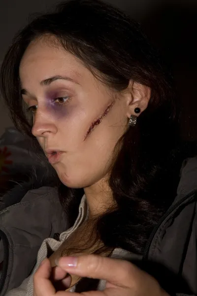 她脸上的瘀伤及瘢痕的特征的女人 — 图库照片