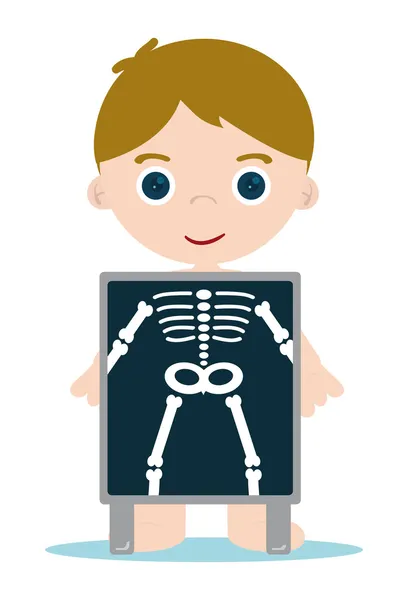Röntgenbild Knochen Kind — Stockfoto