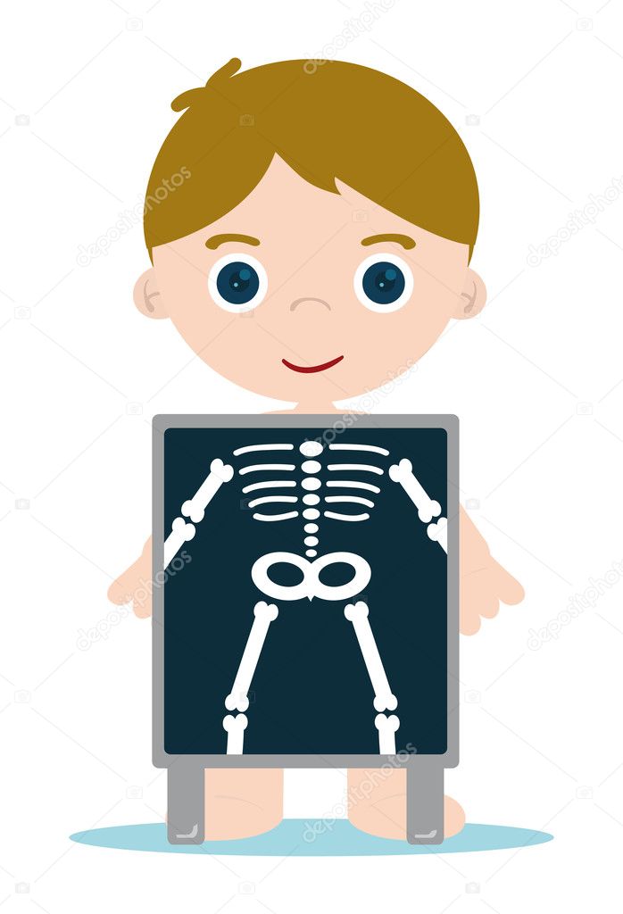 X ray bones kid