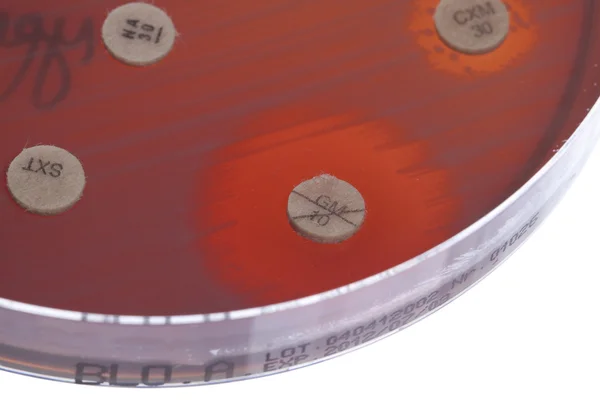 페트리 접시에 있는 박테리아 — 스톡 사진
