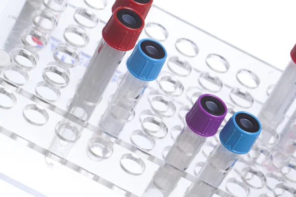 Test tubes on stand — Stock Photo, Image