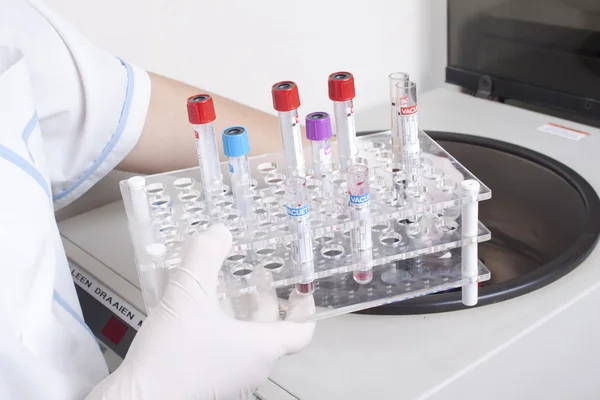 Manos cargan muestras de sangre en centrifugadora —  Fotos de Stock