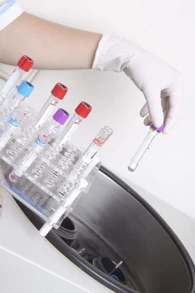 Handen ladingen bloedmonsters in centrifuge — Stockfoto