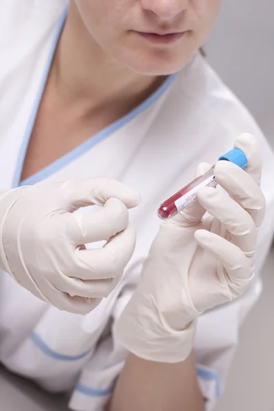 Bedrijf test tube vol bloed — Stockfoto