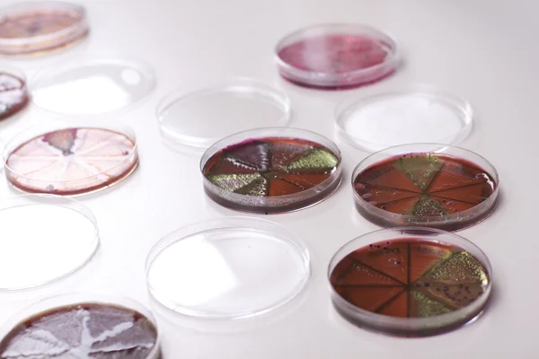 Platos de Petri con bacterias — Foto de Stock