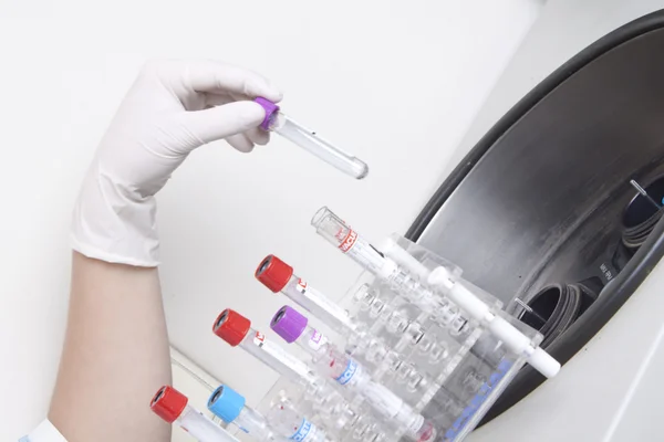 Handen ladingen bloedmonsters in centrifuge — Stockfoto