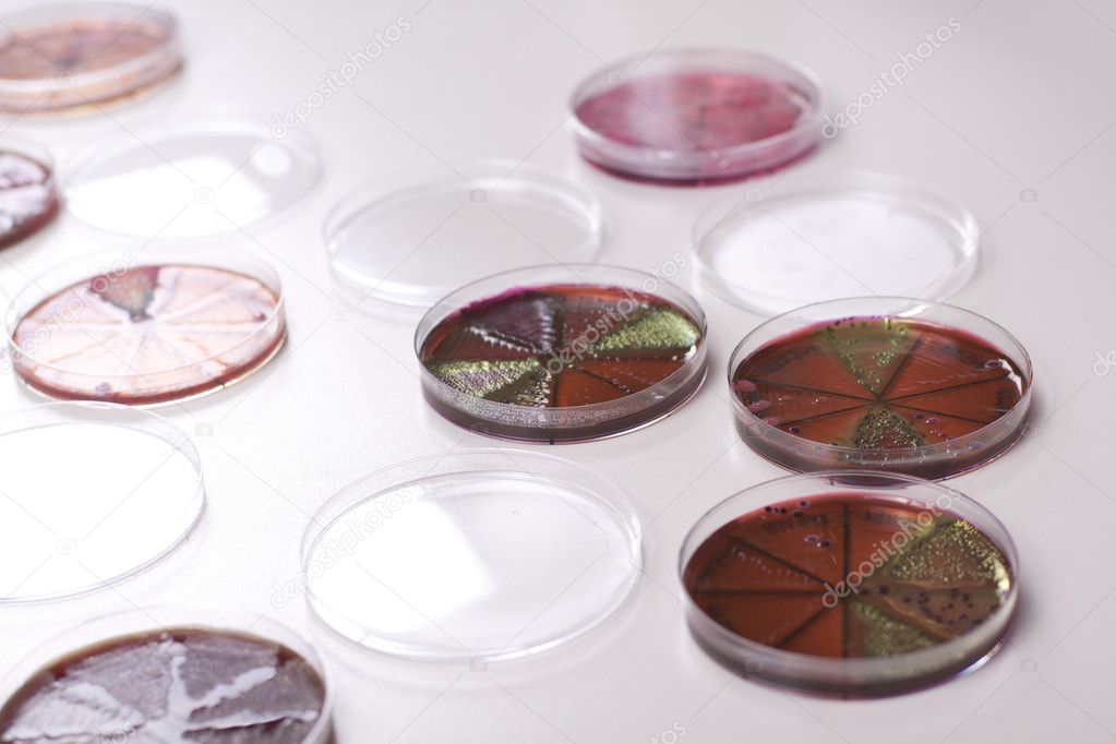 Petri dishes with bacteria