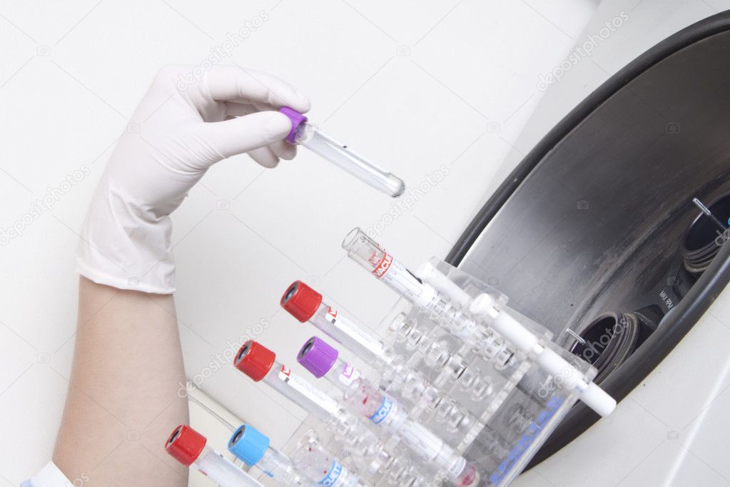 Hands loads blood samples in centrifuge