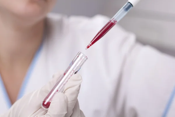 Micro pipetta con sangue — Foto Stock