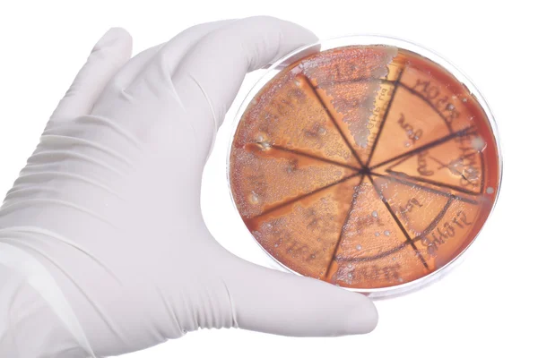 Mão no cravo com placa de Petri — Fotografia de Stock