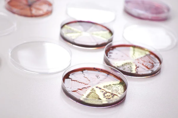 Placas de Petri com bactérias — Fotografia de Stock