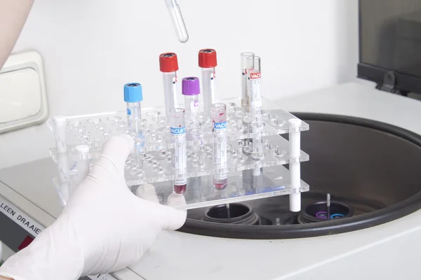 Manos cargan muestras de sangre en centrifugadora —  Fotos de Stock