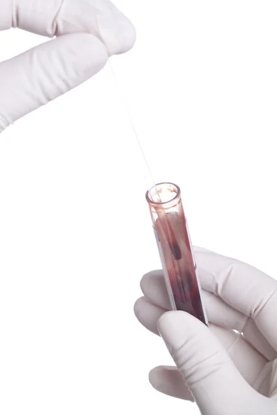 Guante de mano con tubo sanguíneo —  Fotos de Stock