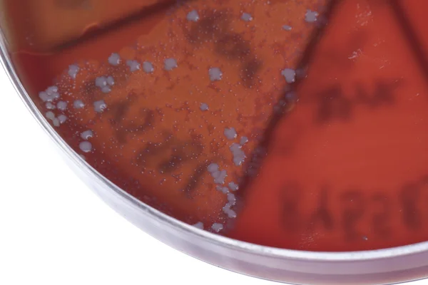 Бактерии на чашке Петри — стоковое фото