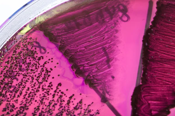 Bakterie na Petriho misce — Stock fotografie