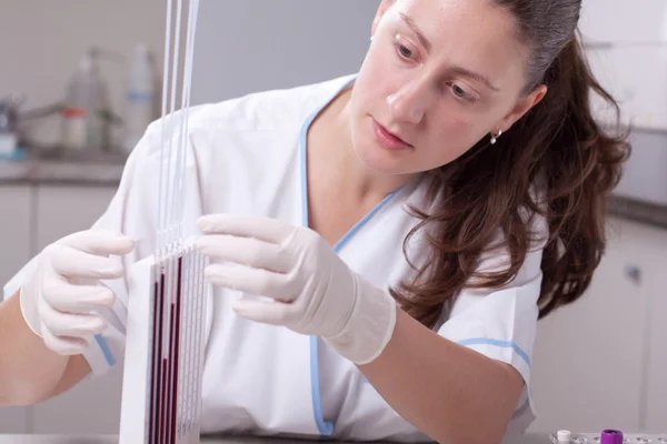 Kobieta lekarz robi badanie szybkości sedymentacji erytrocytów — Zdjęcie stockowe