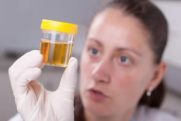 Mulher examinar recipiente de urina Imagens Royalty-Free