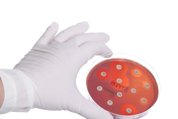 Χέρι-σκελίδα με τρυβλίο Petri — Φωτογραφία Αρχείου