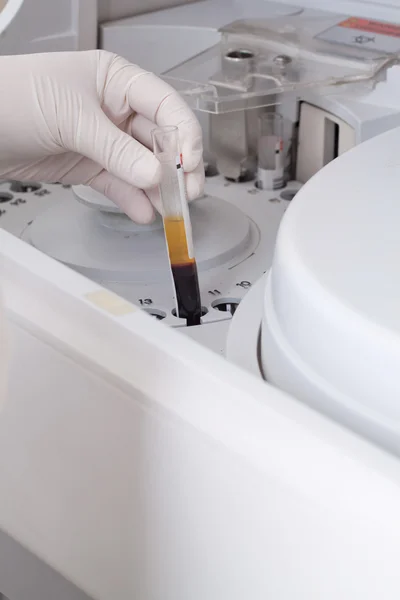 Femme chargeant des échantillons dans un analyseur biochimique — Photo