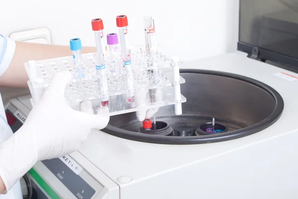 Hands loads blood samples in centrifuge — Stock Photo, Image
