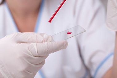 cam üzerinde bırakarak kan damlası