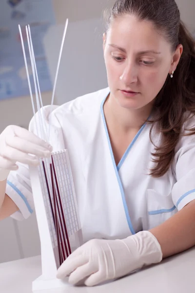 Жінка-лікар робить тест на швидкість осадження еритроцитів — стокове фото