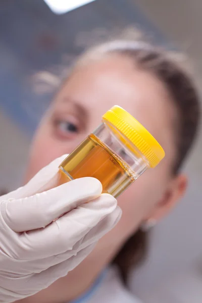 Woman examine urine container — Stock Photo, Image