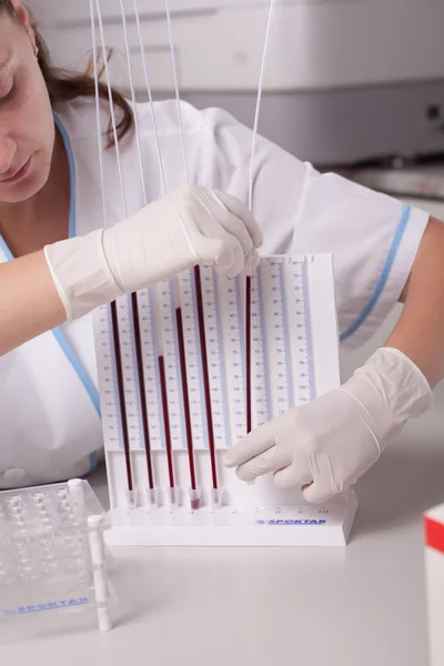Vrouw arts doen erytrocyt sedimentatie tarief test — Stockfoto