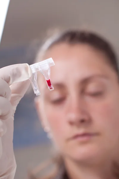 Mulher examinar amostra de sangue — Fotografia de Stock