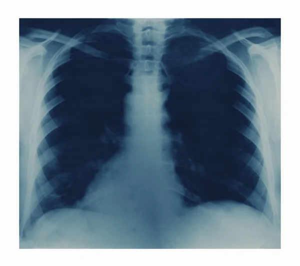 X-ray image — Stock Photo, Image