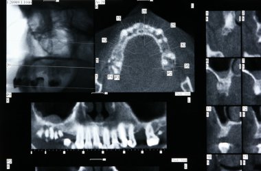 Dental X-ray clipart