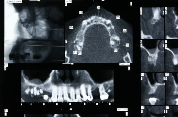 Radiografía dental —  Fotos de Stock