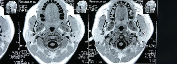 Obrazy rezonansu magnetycznego — Zdjęcie stockowe