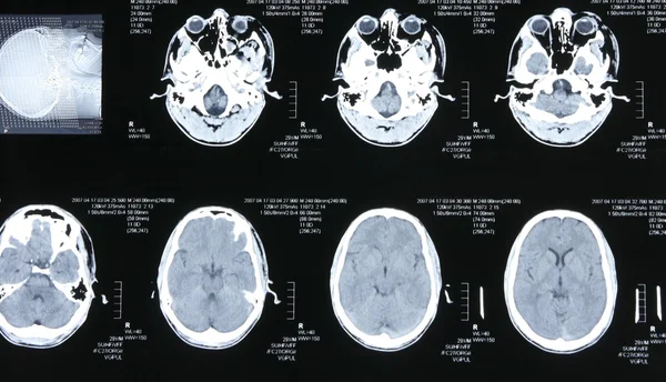 Zobrazení magnetické rezonance — Stock fotografie