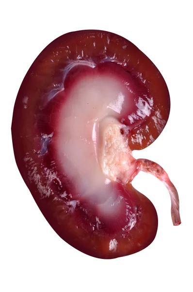 Picture: a real kidney | Real kidney — Stock Photo © magagraphics #11565166