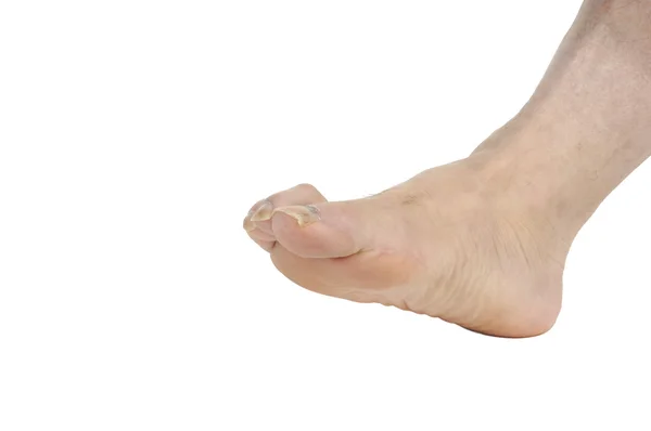 Man's voet — Stockfoto