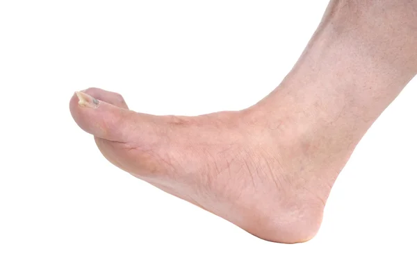 Man's voet — Stockfoto