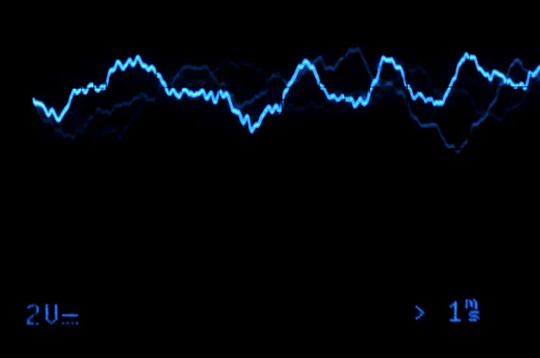 Osciloscopio traza a la música —  Fotos de Stock