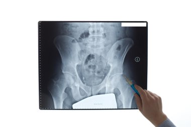Analyzing x-ray image clipart