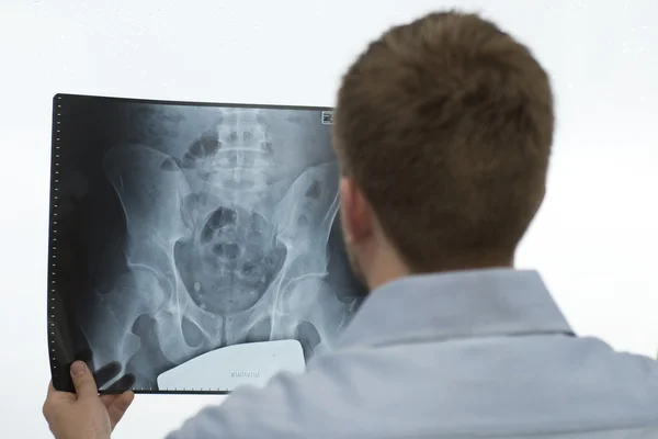 Analysera en röntgenbilden — Stockfoto