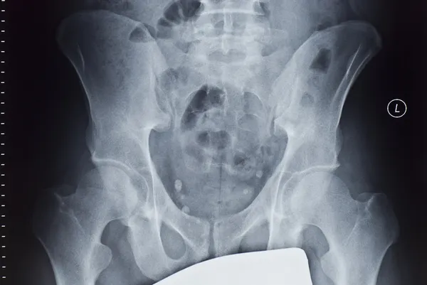 X-ray image — Stock Photo, Image