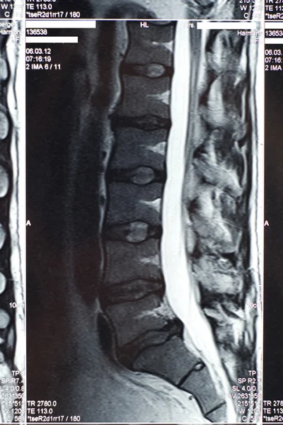 MRI Scan — Stock Photo, Image