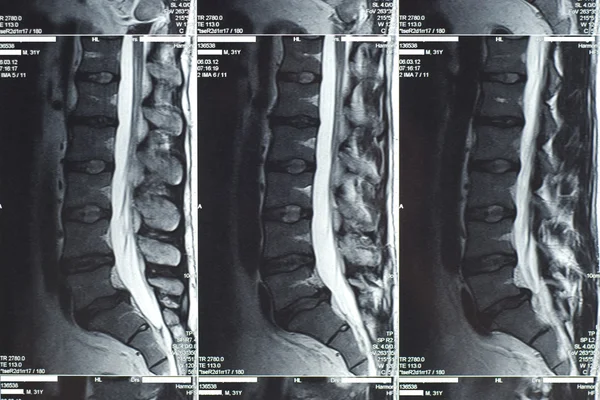 MRI Scan — Stock Photo, Image