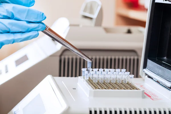 Caricamento di campioni di DNA per PCR — Foto Stock